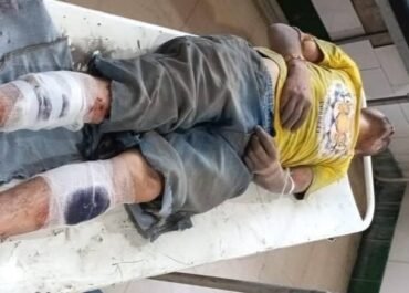 यूट्यूबर बिरजू मयाल पर हमला, गंभीर हालत में अस्पताल में भर्ती।
